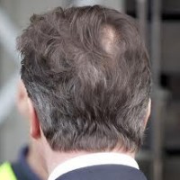 World exclusive! David Cameron hires official photographer to cover up his bald patch